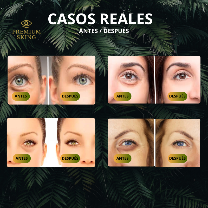 crema para ojeras