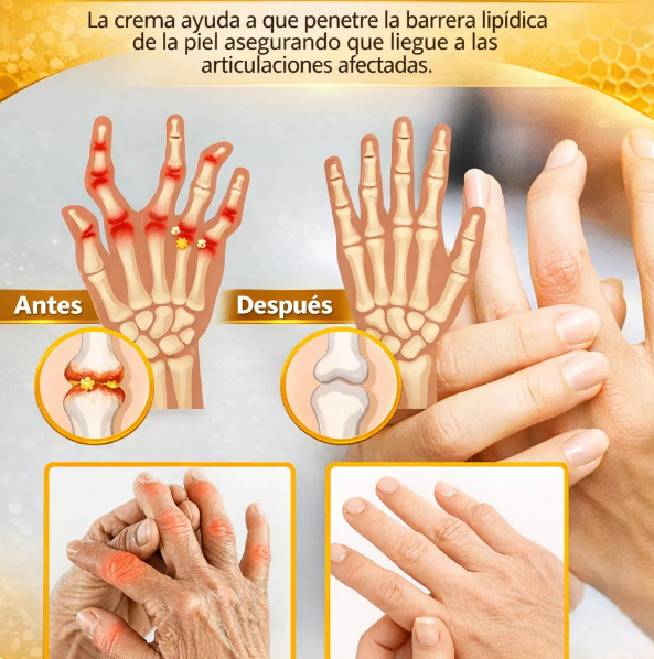 1+1 GRATIS | Premium Sking™ Crema con Veneno de Abeja Mejora tu Piel y Alivia el dolor en Articulaciones