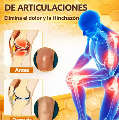 1+1 GRATIS | Premium Sking™ Crema con Veneno de Abeja Mejora tu Piel y Alivia el dolor en Articulaciones