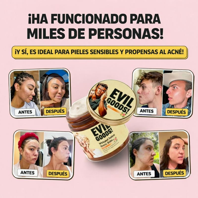 1 + 1 GRATIS | CREMA DE SEBO DE RES PIEL PERFECTA EN 7 DÍAS